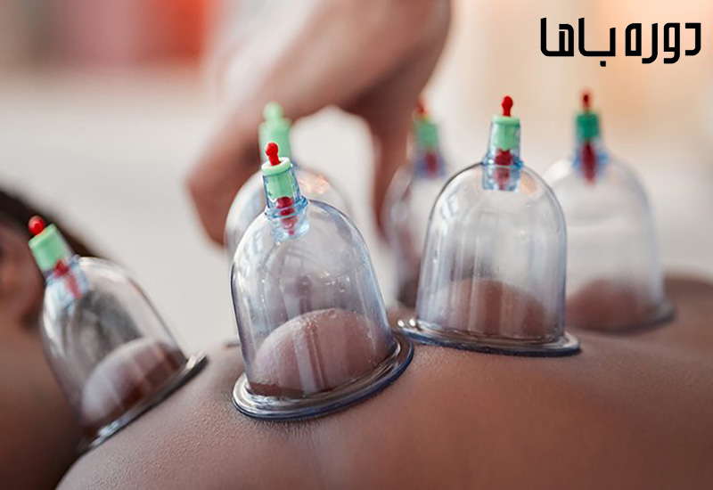 دوره آموزش حجامت