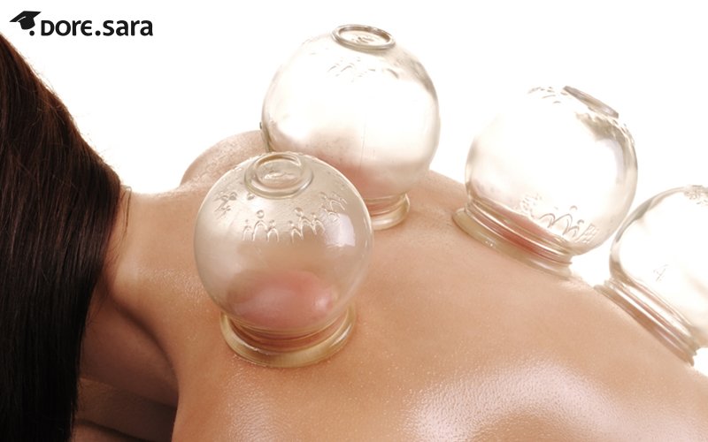 بهترین زمان حجامت چه وقت است؟ 