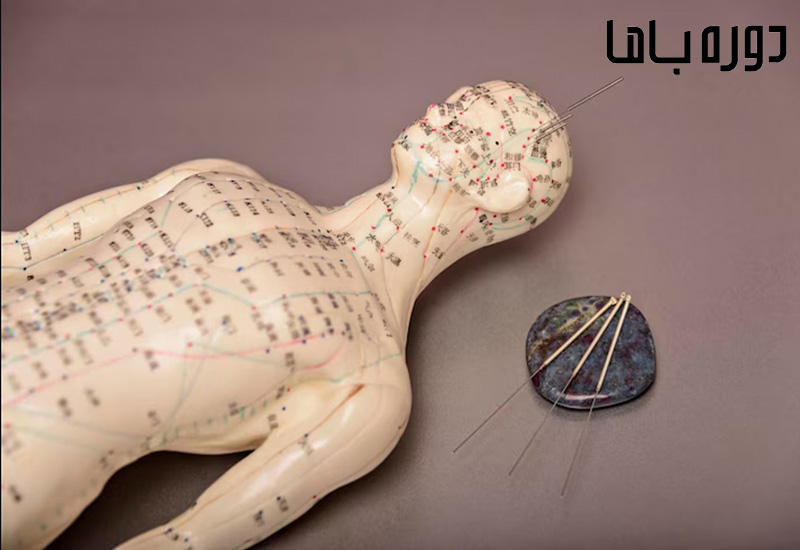 نقاط طب سوزنی
