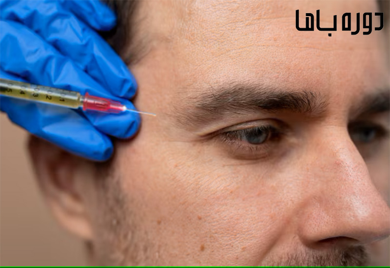 عوارض بوتاکس