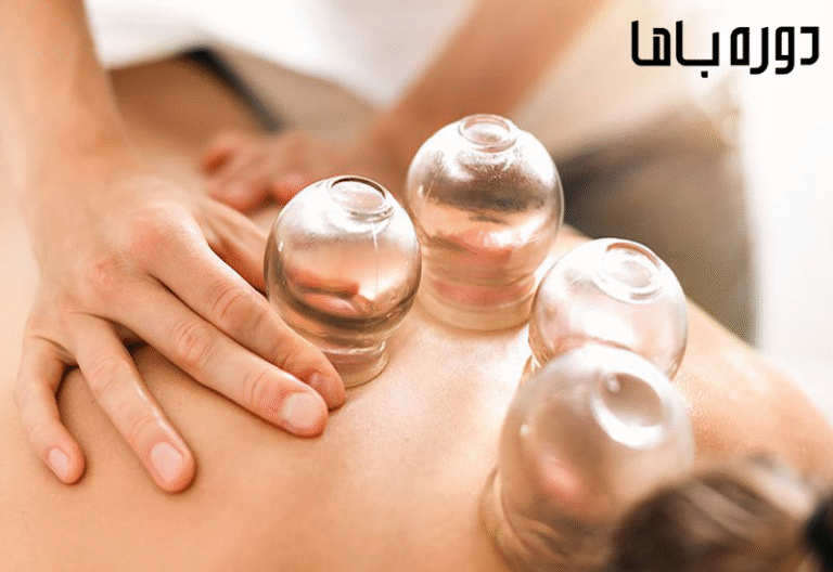 بهترین زمان حجامت