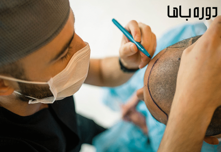 مراقبت‌های بعد از کاشت مو