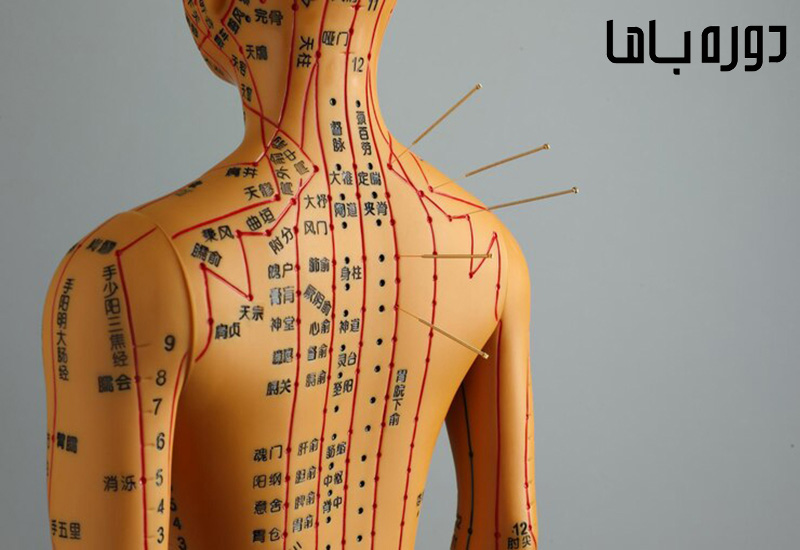 نقشه نقاط طب سوزنی