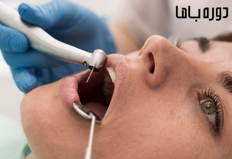 پر کردن دندان‌ها