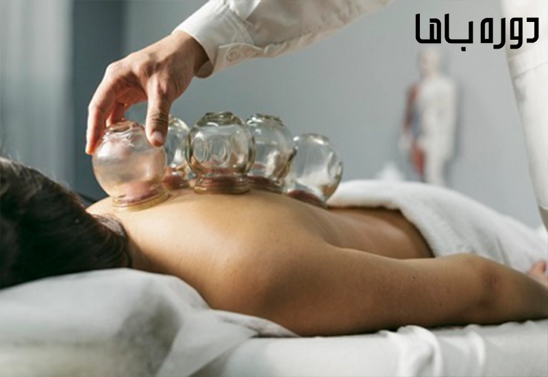 جایگاه بادکش درمانی در بازار کار مدرن