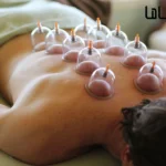 دوره بادکش درمانی