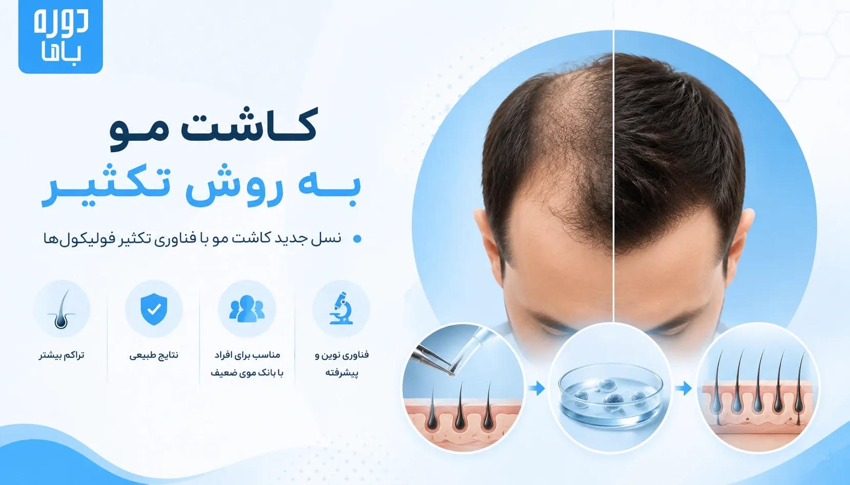 کاشت مو به روش تکثیر چگونه انجام می_شود