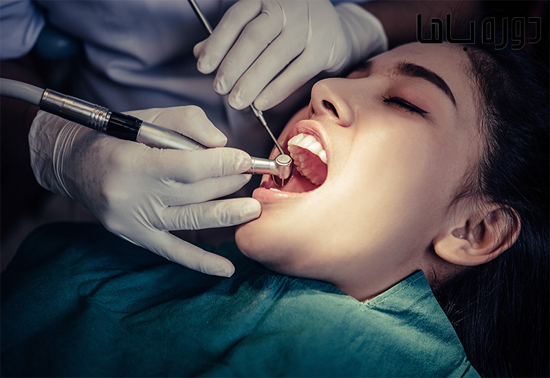 عصب کشی دندان چیست؟ راهنمای کامل درمان ریشه، مراحل، درد و هزینه