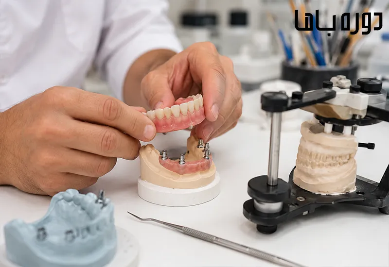 تفاوت اوردنچر با پروتز متحرک معمولی