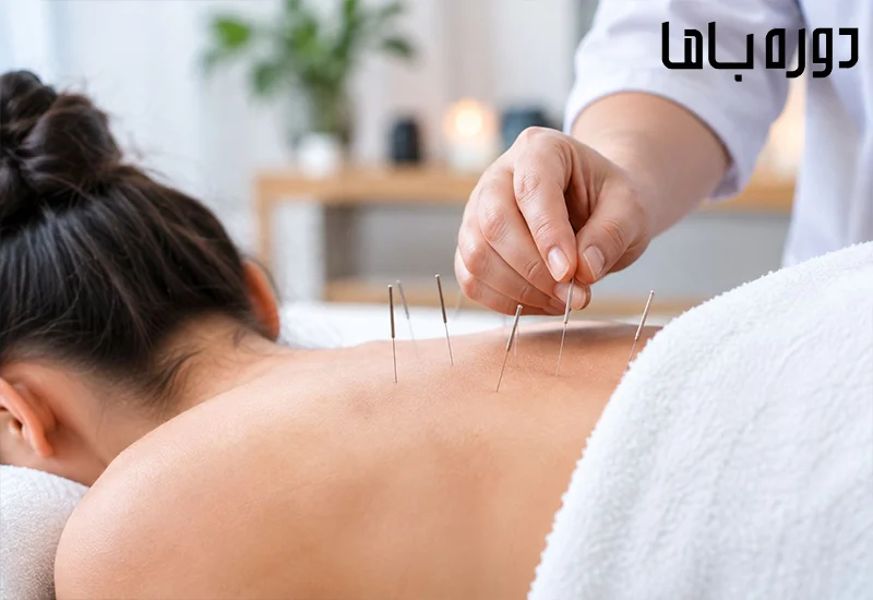 طب سوزنی چه مزایایی دارد
